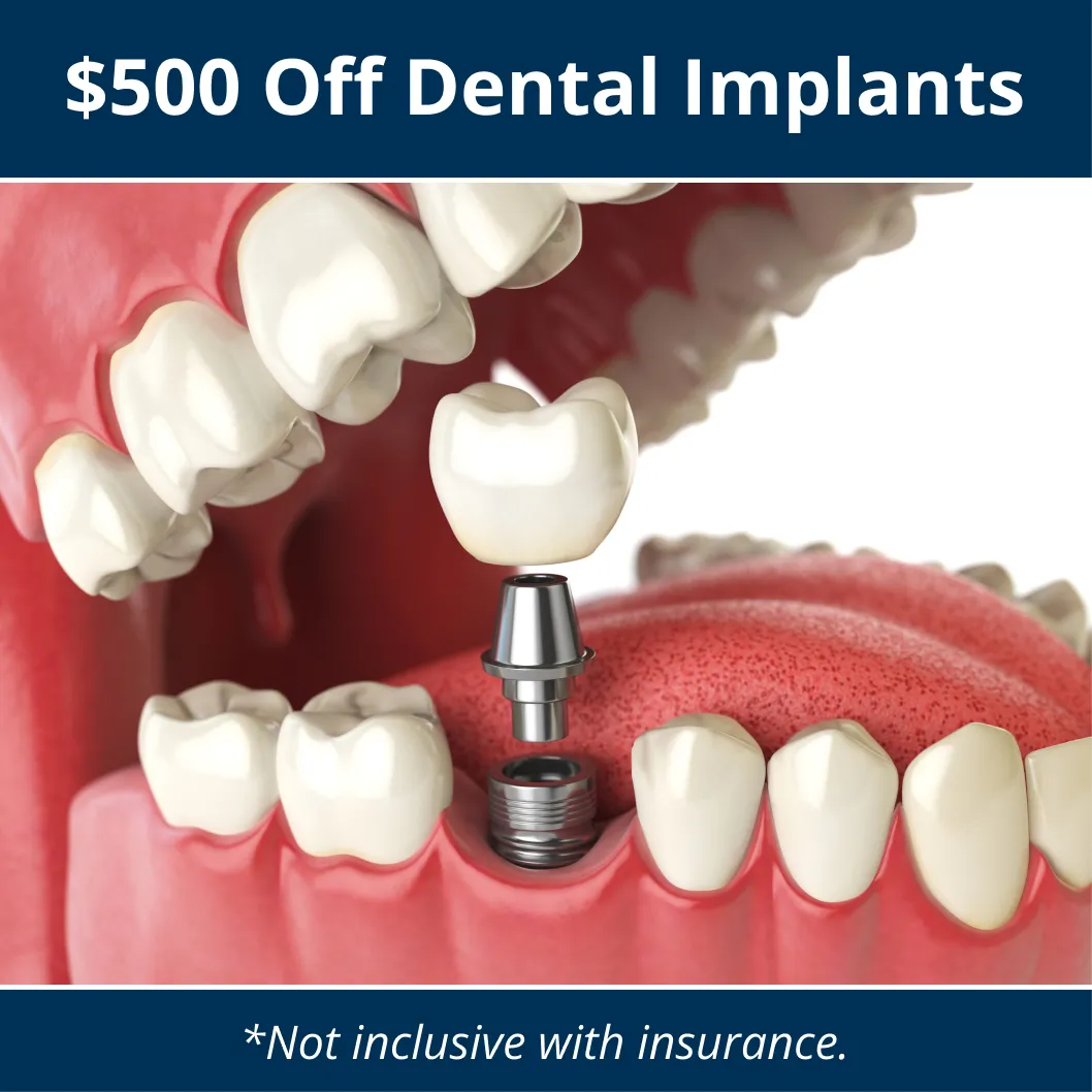 implant special